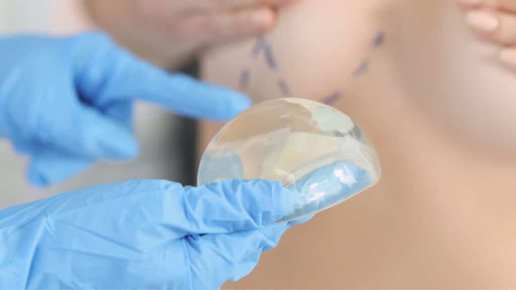 Mellnagyobbítás, mell implantátum Debrecen